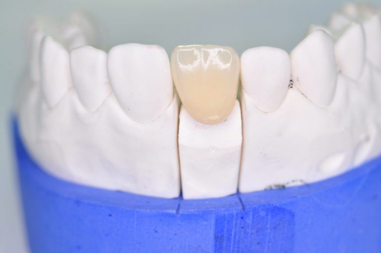 CW Dental Lab