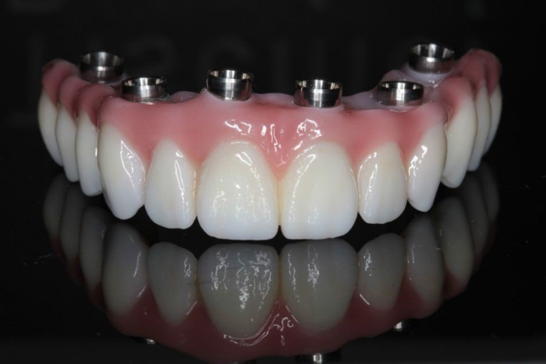 CW Dental Lab