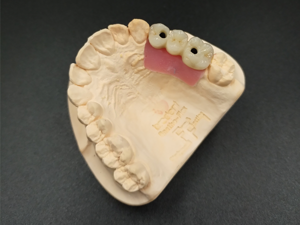 CW Dental Lab