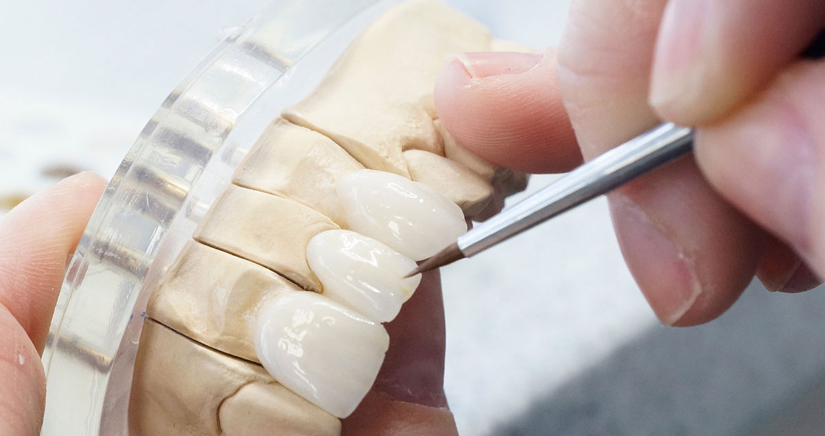 CW Dental Lab